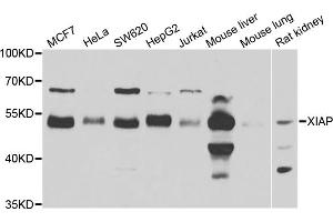 Western blot analysis of extracts of various cell lines, using XIAP antibody (ABIN5974139) at 1/1000 dilution. (XIAP Antikörper)