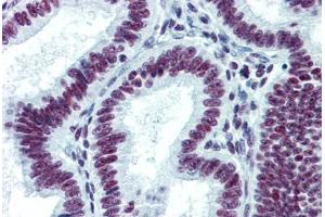 Human Uterus: Formalin-Fixed, Paraffin-Embedded (FFPE) (CDKL1 Antikörper  (AA 259-358))