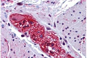 Human Colon, Submucosal Plexus: Formalin-Fixed, Paraffin-Embedded (FFPE) (CABP7 Antikörper  (N-Term))