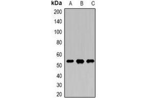 Western blot analysis of DDX39B expression in Hela (A), SKOV3 (B), K562 (C) whole cell lysates.