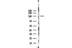 Western blot analysis of lysates from Rat liver, using Nek9 Antibody at 1/1000 dilution.