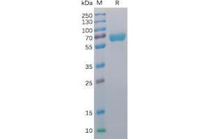Human CD48 Protein, mFc-His Tag on SDS-PAGE under reducing condition.