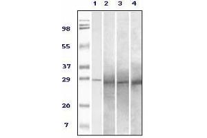 Western Blotting (WB) image for anti-RAB25, Member RAS Oncogene Family (RAB25) antibody (ABIN1108810)