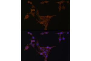 Immunofluorescence analysis of HeLa cells using PPAT Polyclonal Antibody (ABIN6128488, ABIN6146009, ABIN6146010 and ABIN6222409) at dilution of 1:100 (40x lens). (PPAT Antikörper  (AA 1-280))
