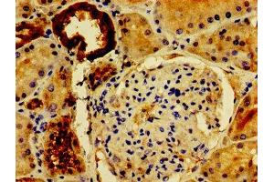 Immunohistochemistry of paraffin-embedded human kidney tissue using ABIN7162672 at dilution of 1:100 (PVALB Antikörper  (AA 2-110))