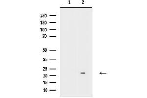 anti-Growth Arrest and DNA-Damage-Inducible, beta (GADD45B) (C-Term) antibody