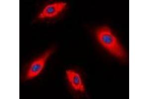 Immunofluorescent analysis of ALPK1 staining in HepG2 cells. (ALPK1 Antikörper  (N-Term))