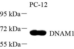 Western blot analysis of DNAM1 (ABIN7073379) at dilution of 1: 500 (CD226 Antikörper)