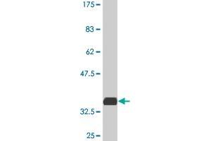 Western Blot detection against Immunogen (36. (SMAD7 Antikörper  (AA 160-260))