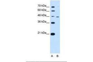 Image no. 2 for anti-Ring Finger Protein 25 (RNF25) (AA 201-250) antibody (ABIN6738069) (RNF25 Antikörper  (AA 201-250))