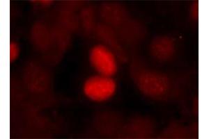 Immunofluorescence staining of manthanol-fixed MCF-7 cells using FOXO1 (phospho S256) polyclonal antibody . (FOXO1 Antikörper  (pSer256))