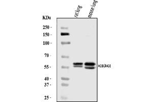 Western blot analysis of RAGE/AGER using anti-RAGE/AGER antibody (ABIN7601722).
