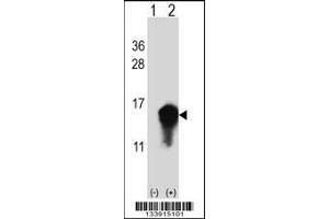 Western blot analysis of CSTA using rabbit polyclonal CSTA Antibody using 293 cell lysates (2 ug/lane) either nontransfected (Lane 1) or transiently transfected (Lane 2) with the CSTA gene. (CSTA Antikörper  (C-Term))