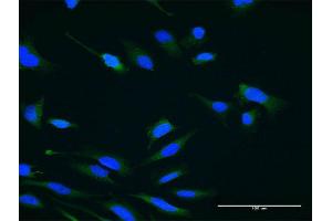 Immunofluorescence of monoclonal antibody to USP47 on HeLa cell. (USP47 Antikörper  (AA 203-301))