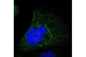 Immunofluorescent staining of human cell line A-431 shows positivity in cytoplasm.