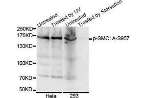 Western Blotting (WB) image for anti-Structural Maintenance of Chromosomes 1A (SMC1A) (pSer957) antibody (ABIN3019554) (SMC1A Antikörper  (pSer957))