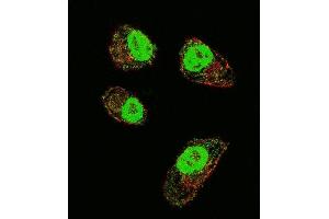 Confocal immunofluorescent analysis of HIF1Alpha Antibody (Center) (ABIN652389 and ABIN2841889) with MDA-M cell followed by Alexa Fluor 488-conjugated goat anti-rabbit lgG (green). (HIF1A Antikörper  (AA 519-547))