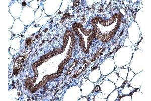 IHC-P Image SLC20A1 antibody [N3C2], Internal detects SLC20A1 protein at membrane and cytoplasm on mouse mammary gland by immunohistochemical analysis. (SLC20A1 Antikörper)