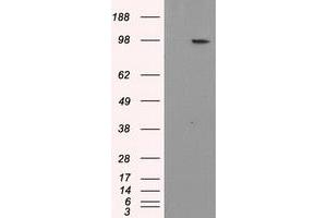 Western Blotting (WB) image for anti-Amyloid beta (A4) Precursor Protein (APP) antibody (ABIN1496879) (APP Antikörper)