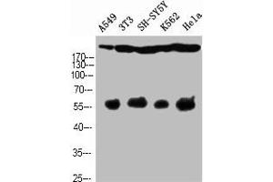 Western Blot analysis of A549 NIH-3T3 SH-SY5Y K562 HELA cells using Cleaved-Notch 4 (V1432) Polyclonal Antibody