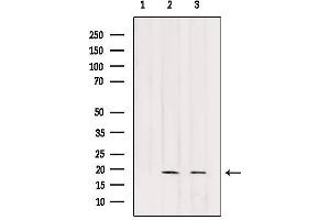 Western blot analysis of extracts from various samples, using RPB7 Antibody.