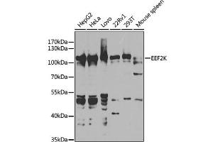 Western blot analysis of extracts of various cell lines, using EEF2K antibody (ABIN6130354, ABIN6139955, ABIN6139956 and ABIN7101771) at 1:1000 dilution.