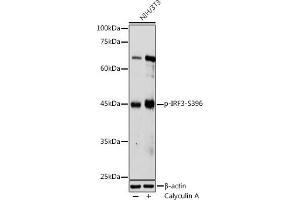 Western blot analysis of extracts of NIH/3T3 cells, using Phospho-IRF3-S396 antibody (ABIN6135244, ABIN6136112, ABIN6136113 and ABIN6225633) at 1:1000 dilution. (IRF3 Antikörper  (pSer396))