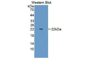 Western blot analysis of recombinant Human PDCD6. (PDCD6 Antikörper  (AA 32-191))