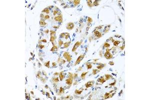 Immunohistochemistry of paraffin-embedded human stomach using PIAS3 antibody (ABIN5974247) at dilution of 1/100 (40x lens). (PIAS3 Antikörper)