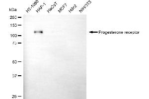 Western blotting analysis using progesterone receptor antibody (ABIN7799906). (Rekombinanter Progesterone Receptor Antikörper)