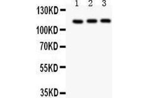 Anti- TRPC5 Picoband antibody, Western blotting All lanes: Anti TRPC5  at 0. (TRPC5 Antikörper  (AA 684-973))