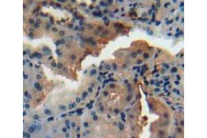 Used in DAB staining on fromalin fixed paraffin-embedded kidney tissue (N-Acetyl alpha-D-Glucosaminidase (AA 485-743) Antikörper)