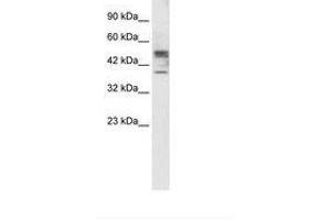 Image no. 2 for anti-Carbohydrate (N-Acetylglucosamine 6-O) Sulfotransferase 4 (CHST4) (AA 156-205) antibody (ABIN202397)