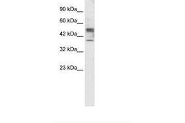 CHST4 抗体  (AA 156-205)