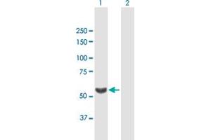 Western Blot analysis of TBL1X expression in transfected 293T cell line by TBL1X MaxPab polyclonal antibody. (TBL1X Antikörper  (AA 1-526))