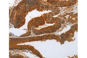 Immunohistochemistry (IHC) image for anti-Notch 3 (NOTCH3) antibody (ABIN6220071) (NOTCH3 Antikörper)