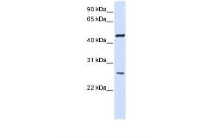 ransfected 293T cell lysate. (TMEM127 Antikörper  (AA 110-159))
