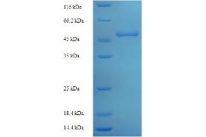SDS-PAGE (SDS) image for Ornithine Carbamoyltransferase (OTC) (AA 33-354) protein (His-SUMO Tag) (ABIN5710051) (OTC Protein (AA 33-354) (His-SUMO Tag))