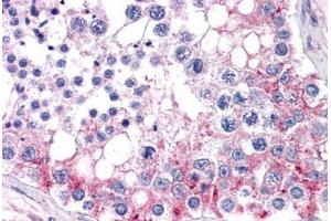 Human Testis (formalin-fixed, paraffin-embedded) stained with ABCB9 antibody ABIN351468 at 3. (ABCB9 Antikörper  (AA 757-769))