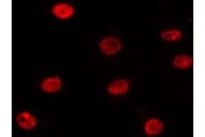 ABIN6275197 staining 293T by IF/ICC. (SIX Homeobox 1 Antikörper  (Internal Region))