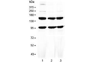 Western blot testing of human 1) HeLa, 2) MCF7 and 3) HepG2 cell lysate with VEGFR3 antibody at 0. (FLT4 Antikörper)