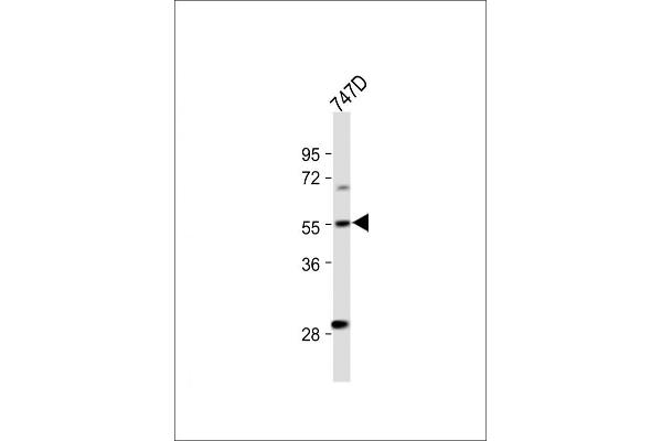 CYP27B1 Antikörper  (C-Term)