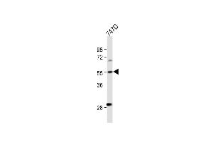 All lanes : Anti-CYP27B1 Antibody (C-term) at 1:500 dilution Lane 1: T47D whole cell lysate Lysates/proteins at 20 μg per lane.