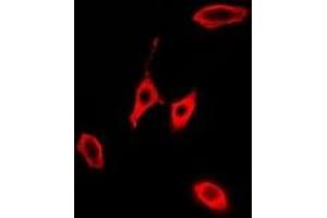 Immunofluorescent analysis of KLK10 staining in A549 cells. (Kallikrein 10 Antikörper)