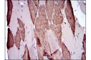 Immunohistochemical analysis of paraffin-embedded muscle tissues using Lplunc1 mouse mAb with DAB staining. (BPIFB1 Antikörper)