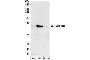 anti-La Ribonucleoprotein Domain Family, Member 4B (LARP4B) (AA 450-500) antibody