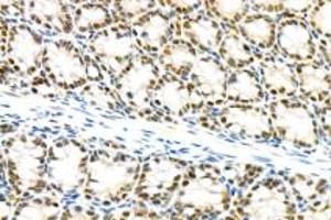 Immunohistochemistry analysis of paraffin-embedded mouse colon using mSin3A (ABIN7075609) at dilution of 1: 100 (SIN3A Antikörper)