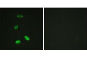 Immunofluorescence analysis of HeLa cells, using MYB (Ab-12) Antibody. (MYB Antikörper  (AA 1-50))