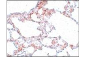 Immunohistochemistry of MRE11 in rat lung tissue with MRE11 antibody at 5 μg/ml. (Mre11 Antikörper  (N-Term))
