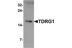 Western blot analysis of TDRG1 in human testis tissue lysate with TDRG1 Antibody  at 1 μg/ml (TDRG1 Antikörper  (Middle Region))